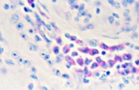  Плазматичні клітини в стромі нирок